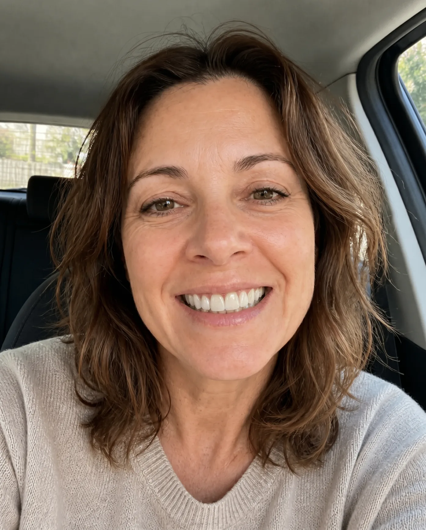 AI-generated smile preview after treatment