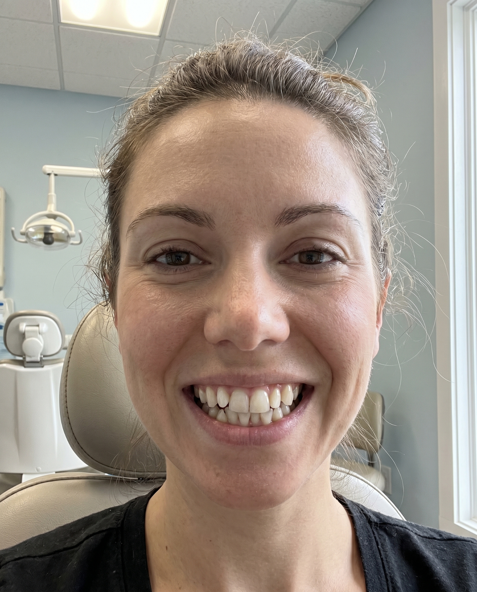 Patient smile before treatment
